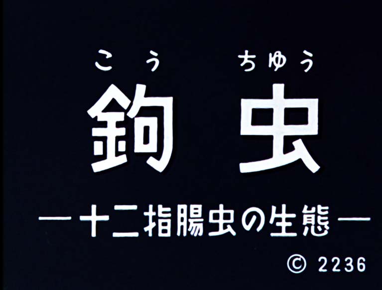 鉤虫　十二指腸虫の生態