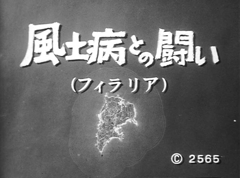 風土病との闘い　フィラリア