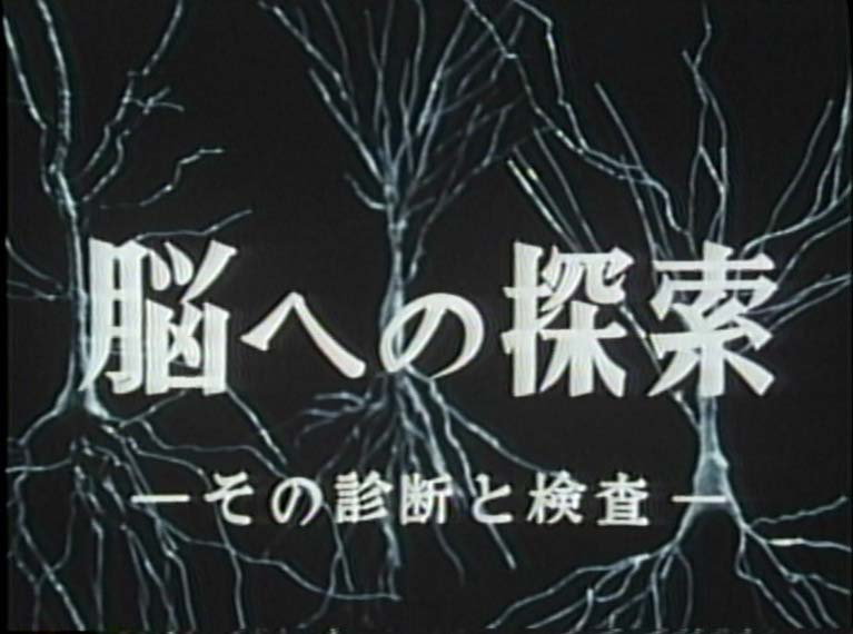 脳への探索　その診断と検査