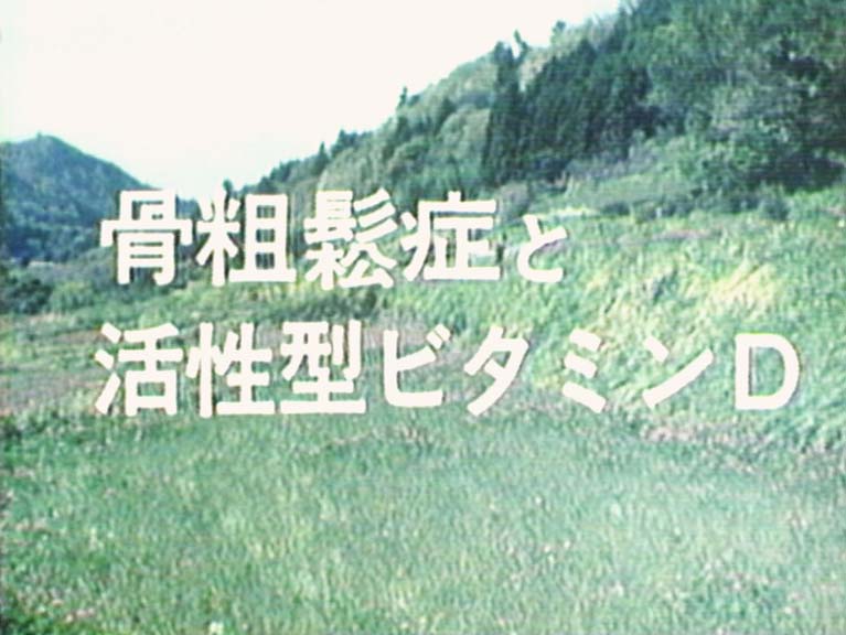 骨粗鬆症と活性型ビタミンＤ