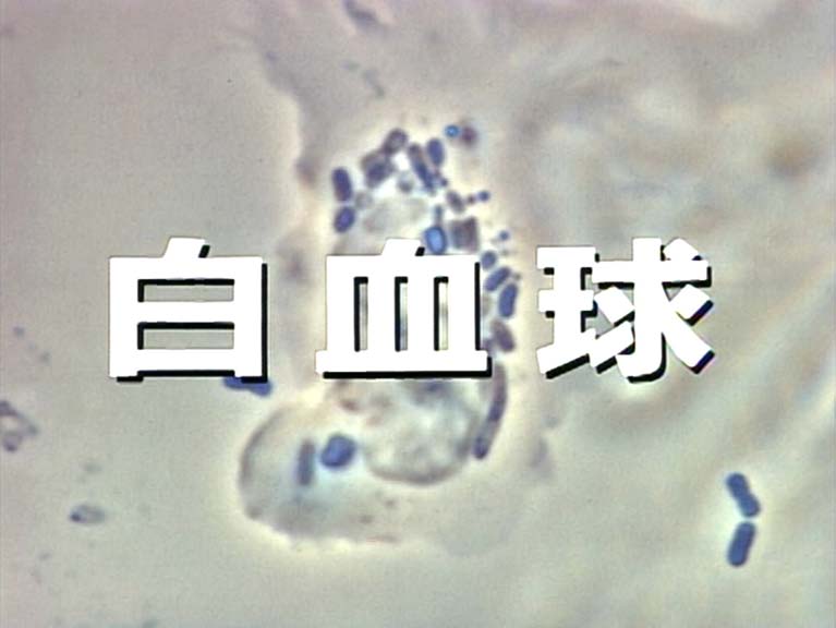 白血球　その増殖・活性化因子Ｇ−ＣＳＦを求めて