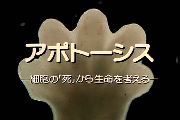 アポトーシス　　細胞の「死」から生命を考える