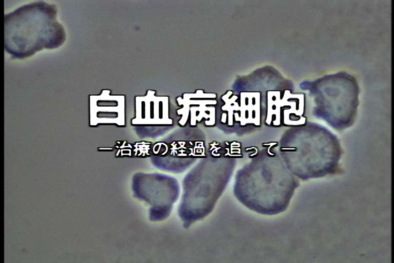 白血病細胞　治療の経過を追って