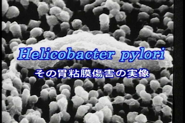 Helicobacter pylori  その胃粘膜傷害の実像