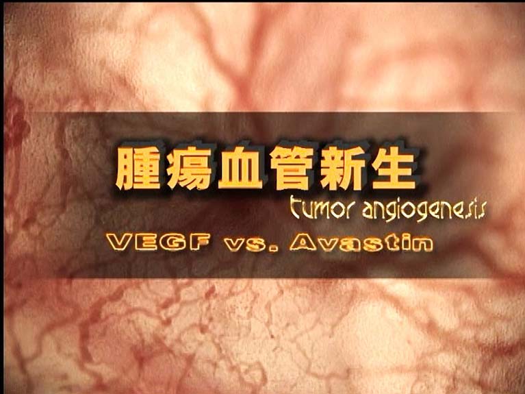 腫瘍血管新生　　VEGF vs Avastin